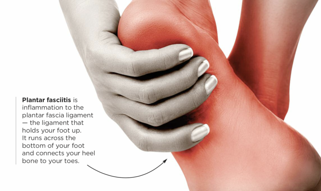 Pic of woman holding bottom of her foot that is red and inflamed with a brief text description of that Plantar Fasciitis is.